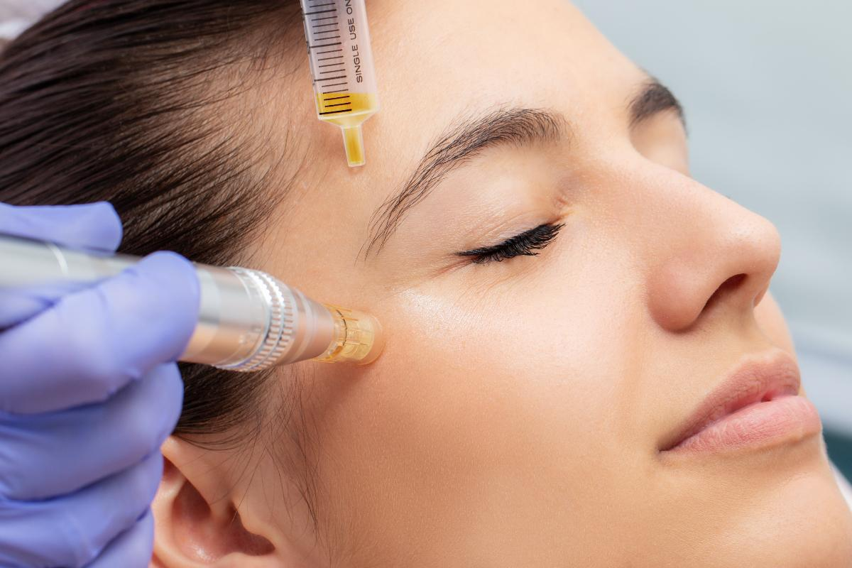 Stem Cell Therapy