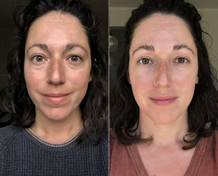 before after gua sha