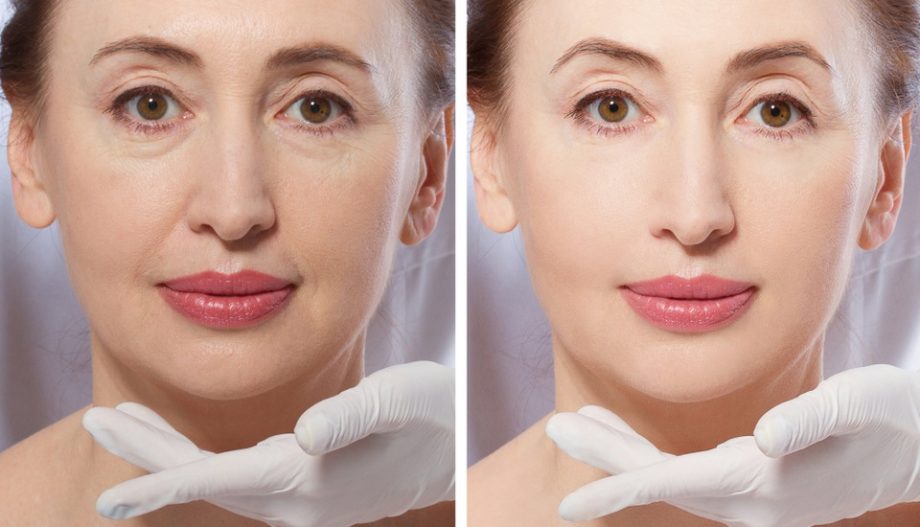 stem cell therapy