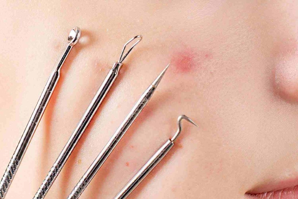 blackhead removal tool