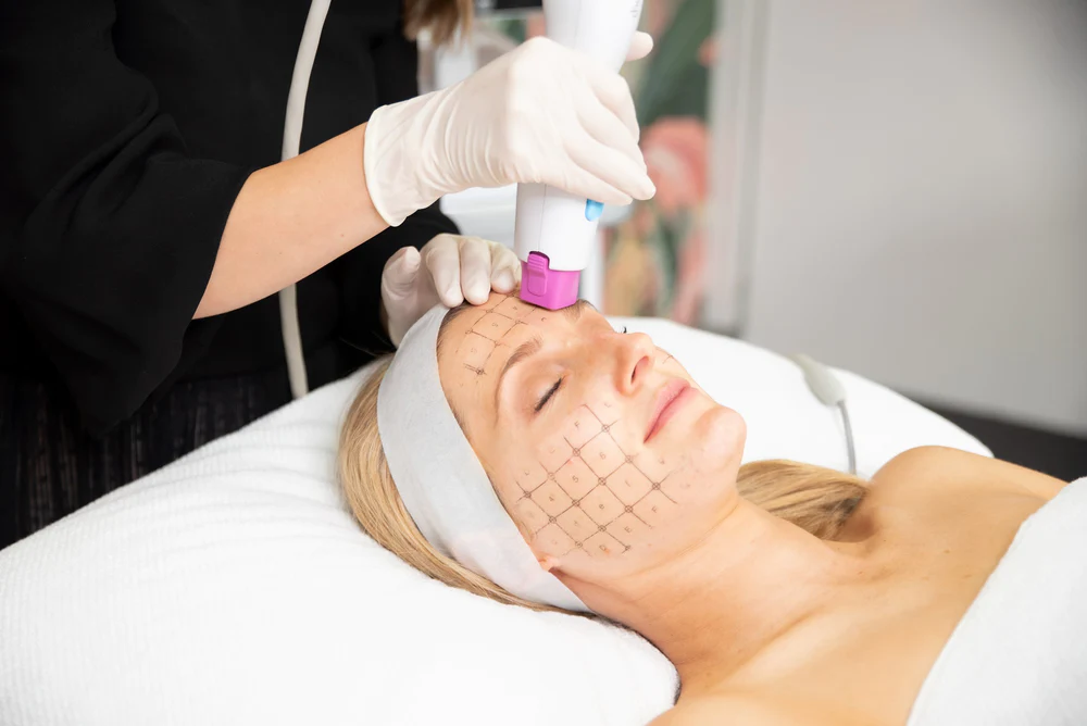 Thermage vs HIFU: Which Skin Treatment is Right for You?