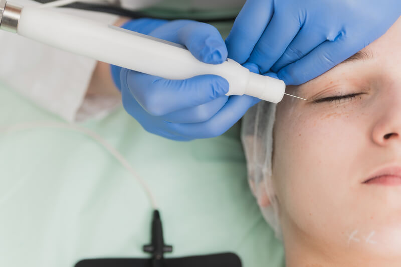 Cold Plasma Treatment