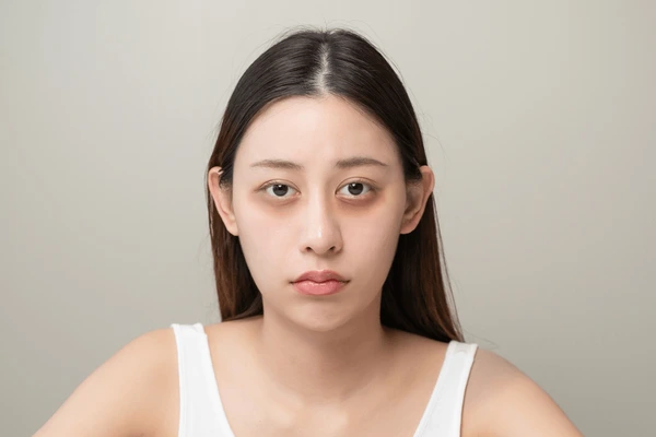 How to Remove Eyebags