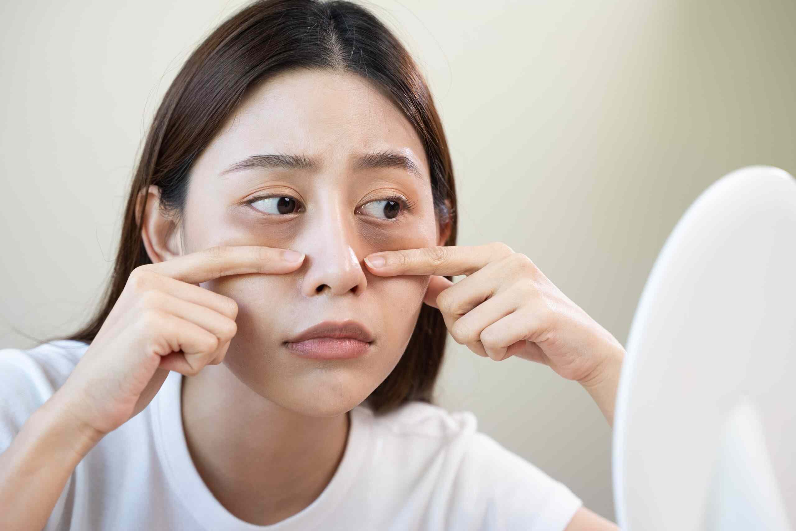 How to Remove Eyebags Easily, Say Goodbye to Tired Eyes!