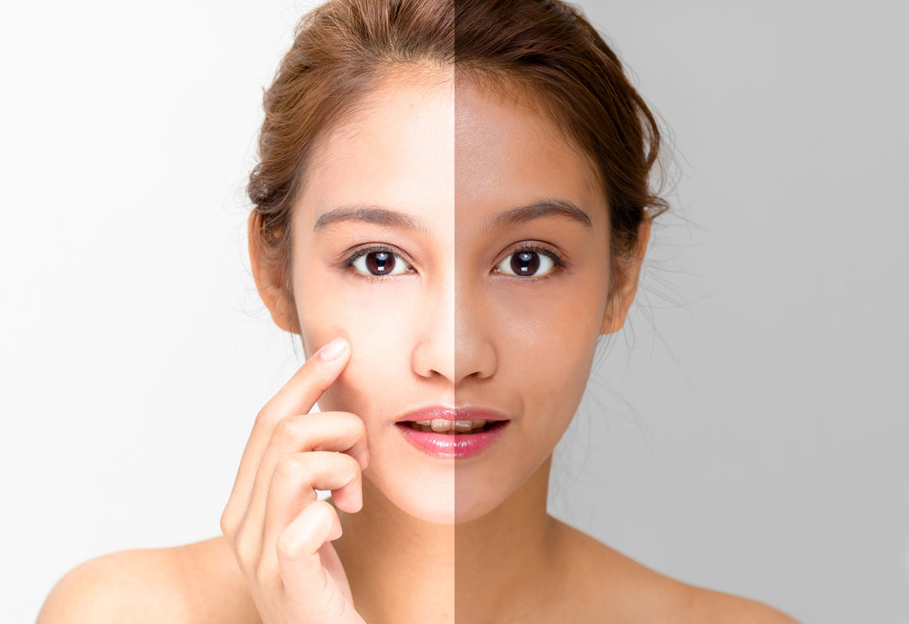 5 Effective Skin Brightening Treatment in Singapore