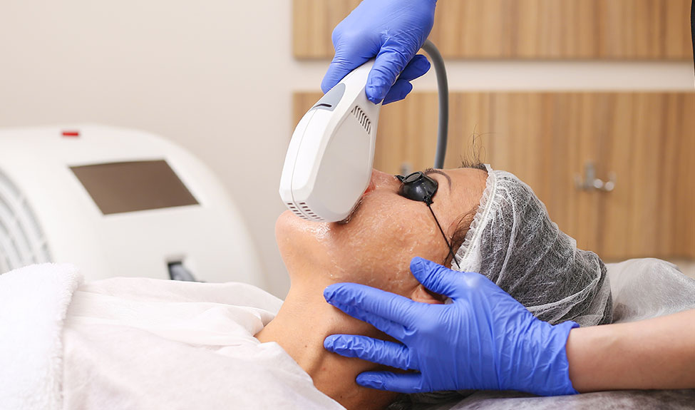 ipl treatment