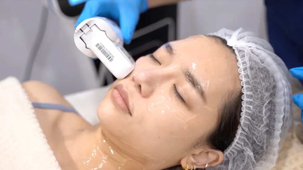 How Long Does HIFU Face Lift Last?